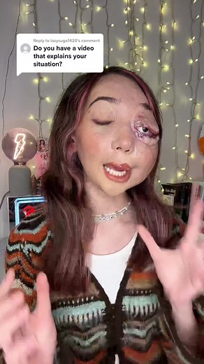 Understanding Nikki Lilly's Condition: Face Transformation Revealed