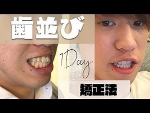 【セラミック】たった1日で歯並びが変わった方法
