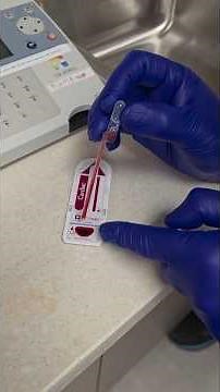 Triage Meter - running patient specimens