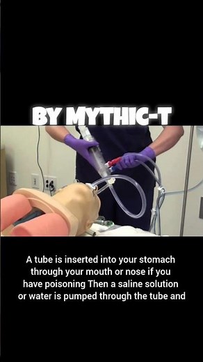 How a Gastric lavage works