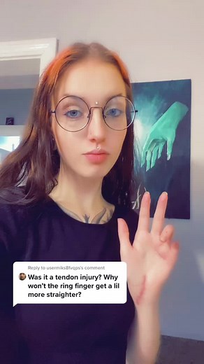 Understanding Ring Finger Tendon Issues in Amputee Hand