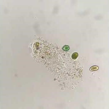 Infusoria Stentor under the microscope.