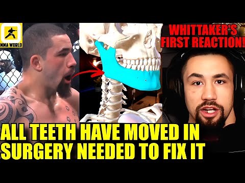 New details revealed of Robert Whittaker's SHATTERED JAW by Khamzat Chimaev's choke,Ilia Topuria,UFC