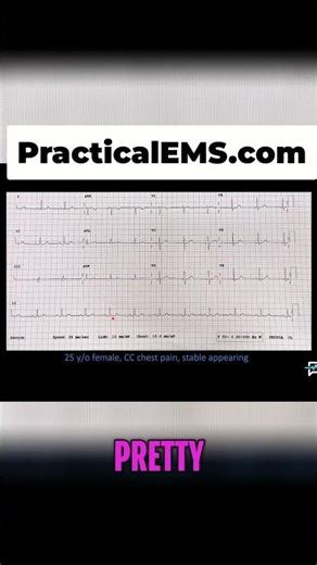 EKG Explained: Normal Sinus Rhythm & What to Do! #shorts