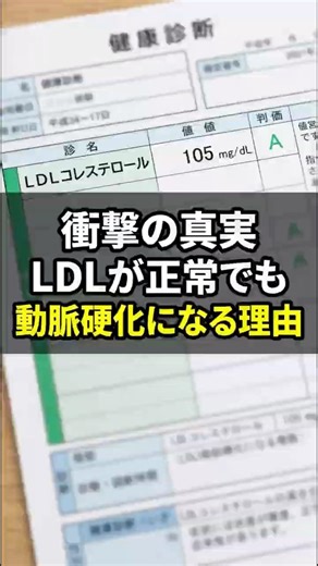 【医師が解説】「コレステロール値が正常だから安心」は大間違い！？