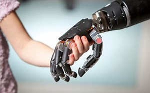 仿生手臂（Bionic Arm）