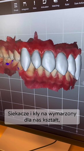 Exploring Dental Procedures with Innovative Technology