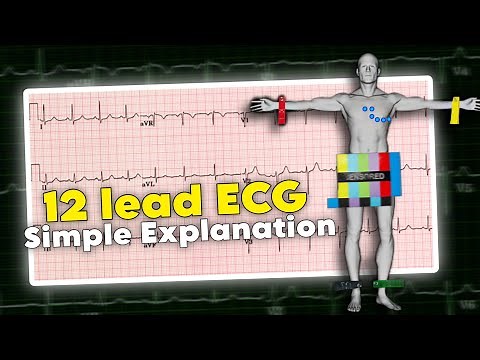 12 lead ECG | ECG interpretation made easy • Daily Cardiology