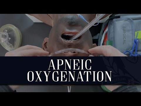 ApOx - Apneic Oxygenation