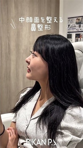 【鼻孔縁修正】理想通りにならなかった鼻を他院修正