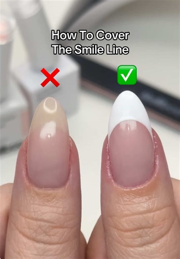 How to Create the Perfect French Tip to Cover Smile Lines