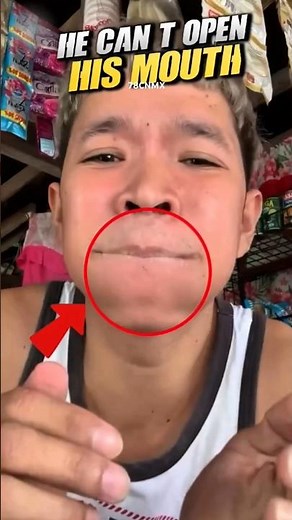 He Glued His Lips Shut What Happens Next Is HILARIOUS!" #funfact #funny #funnyvideo #short #shorts