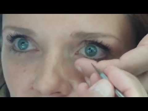 Yeux secs : comment poser des bouchons méatiques