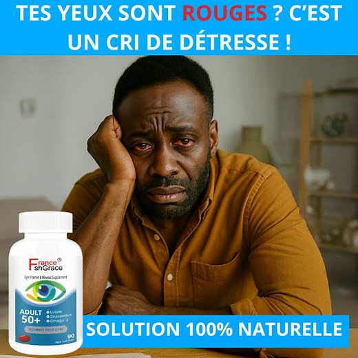 55 reactions · 4 comments |  Vos yeux brûlent, piquent ou deviennent...