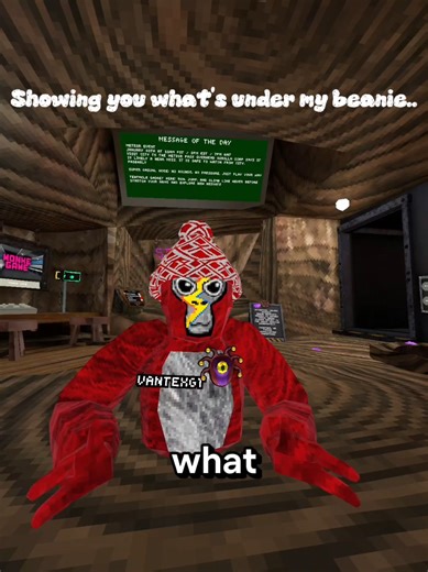 Discover What's Under My Beanie