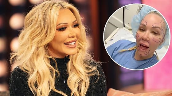 Jelly Roll’s Wife Bunnie Xo Shares Raw Look at Appearance After Facelift