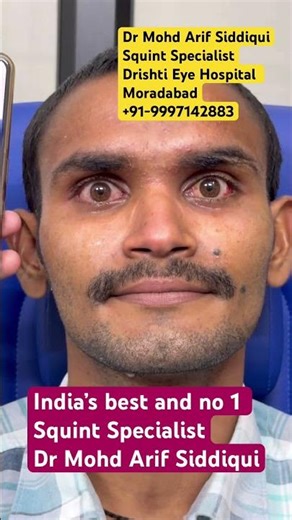 Power of Squint surgery | amazing transformation in just 1 week | Dr MA Siddiqui #squint #eyecare