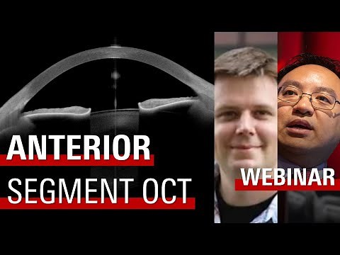 Anterior Segment OCT: Hang-Ups and Next Evolutions (November 2020)
