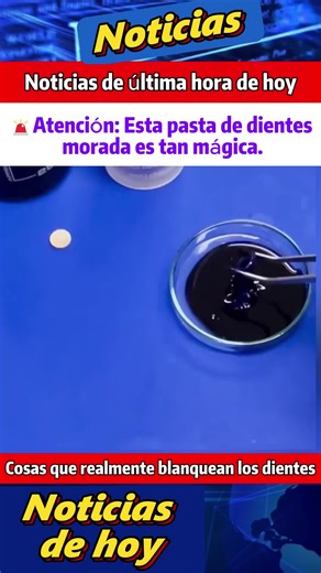 Elige la pasta de dientes adecuada para limpiar tus dientes#pastadental #cuidadodental #cariesdental #dientesfijos