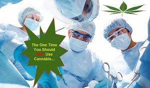 Cannabis Patient: What Should I Do After Oral Surgery?