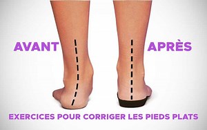 Pieds Plats : Exercices pour Corriger l'Arche du Pied - Remèdes de Grand-Mère