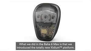 2.7K views · 32 reactions | From your loved ones’ laughter to the crisp sounds of nature, hear the sounds you really love in your life with the Baha 6 Max Sound Processor. A premium-power bone conduction sound processor that doesn’t compromise on important features, the Baha 6 Max provides the output of a power device while maintaining a small and discreet design. Discover more: https://bit.ly/3Ellx2S | Cochlear Americas | Facebook
