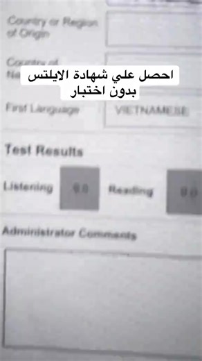 شهادة IELTS (اختصارًا لـ International English Language Testing System) هي شهادة دولية تقيس مهارات اللغة الإنجليزية للأشخاص غير الناطقين بها. تُعد واحدة من أكثر الاختبارات اعتمادًا في العالم للأغراض الأكاديمية والهجرة والعمل. مكونات الاختبار: يقيس اختبار الآيلتس أربع مهارات أساسية في اللغة: 1. الاستماع (Listening): اختبار مدته 30 دقيقة يحتوي على تسجيلات لمواقف مختلفة باللغة الإنجليزية. 2. القراءة (Reading): مدته 60 دقيقة، ويتضمن نصوصًا وأسئلة لقياس فهمك للنصوص المكتوبة. 3. الكتابة (Writing): مدت