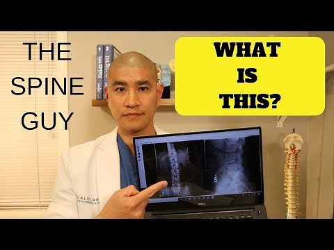 How to read a Lumbar X-ray