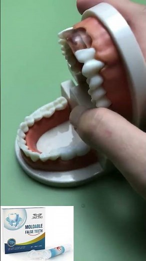 Fix a chipped tooth at home using moldable plastic. Quick, easy and budget-friendly #teeth #repair