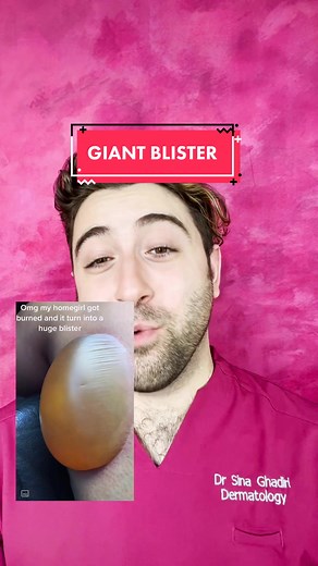 #pimplepop #pimpleremoval #pimplepopper #pimple #whiteheads #whiteheadremoval #whitehead #blackhead #cyst #blister