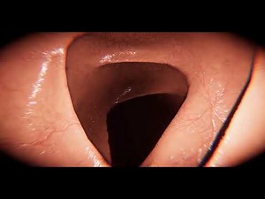 Virtual Physical Simulation of Capsule Endoscopy