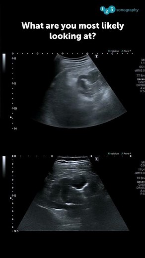 What are you most likely looking at? 🧐