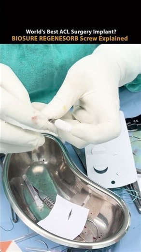 World's Best ACL Surgery Implant? | BIOSURE REGENESORB Screw Explained | Dr. Dhruv Sharma