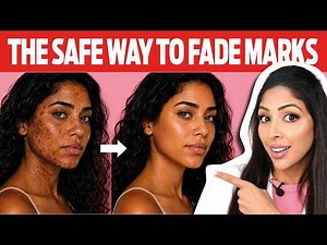 Professional Hyperpigmentation treatment Melanin-Rich skin