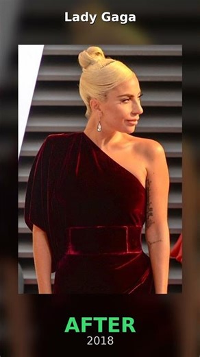 Lady Gaga's INSANE glow up 87 to 18 😱#Shorts