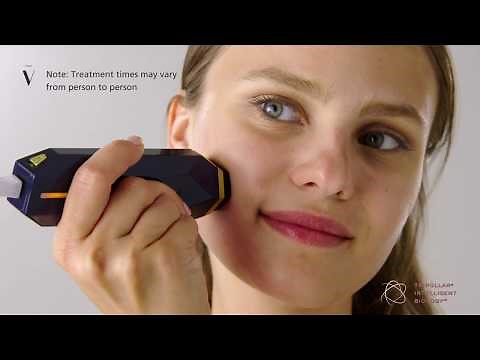 TRIPOLLAR STOP V - With RF and DMA Technology | Antiaging, Wrinkle Reducer & Face-lifting Device