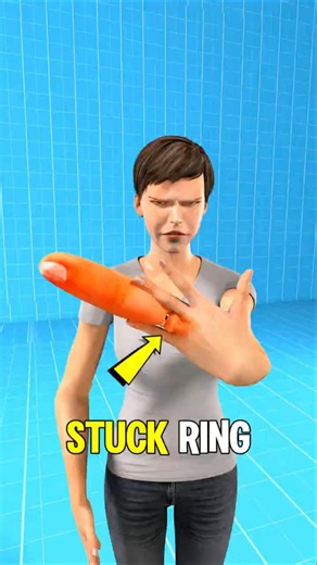 How to Safely Remove a Ring From a Swollen Finger 😳