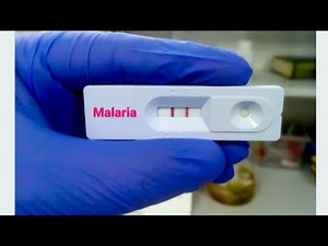 How To Use Malaria Rapid Diagnostic Test ( Step by Step)