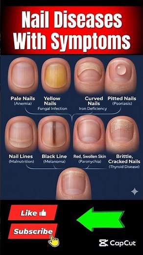 What Your Nails Say About Your Health | Hidden Deficiencies Explained #healthylifestyle #healthydiet