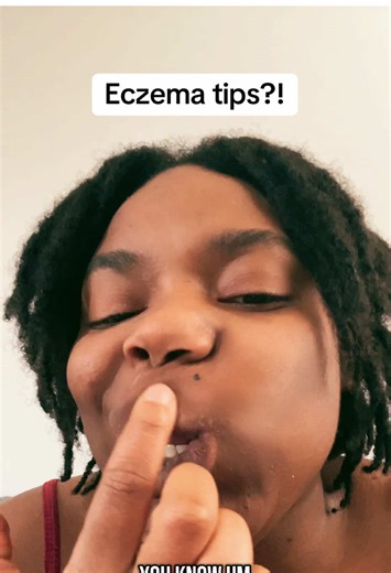 Lip Eczema Solutions: Tips and Tricks for Relief
