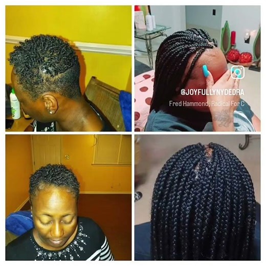 Box Braids on alopecia client #Natural hairstyle for short hair#