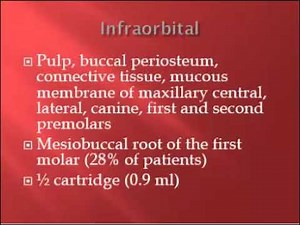 Local Anesthesia for Dental Hygienists Test Prep including IO