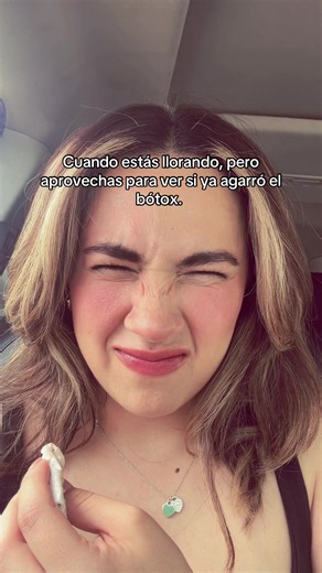 ¿Se nota el Botox cuando lloras? preocupación común entre girls