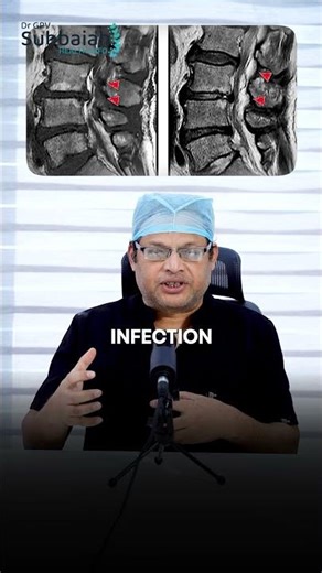 Which scan is best for back pain | Dr GPV Subbaiah| #backpain #backpainrelief #lowbackpain #back