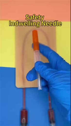 Safety Indwelling Needle: Enhancing IV Therapy