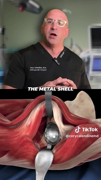 Bone Doctor - Joint Pain MD on TikTok
