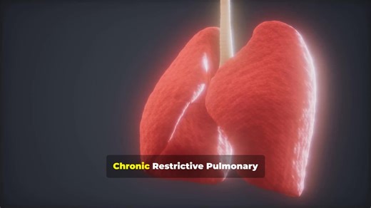 CRPD: Breathe Better, Move Better A concise guide to Chronic Restrictive Pulmonary Disease (CRPD) for pulmonary rehab patients: what CRPD is, key causes (interstitial lung disease, thoracic deformity, neuromuscular disorders), common symptoms (reduced TLC/VC, hypoxemia, breathlessness), and practical treatment and exercise strategies—oxygen therapy, meds, pulmonary rehab, 6-minute walk test monitoring (SpO₂, RPE), aerobic training (50–80% VO₂ peak), light strength work, and breathing techniques 