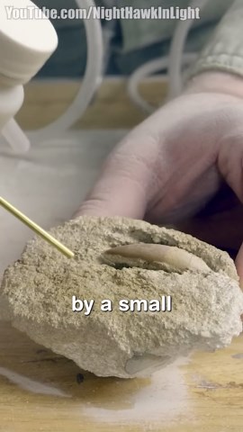 Fossilized Tooth Extraction #shorts