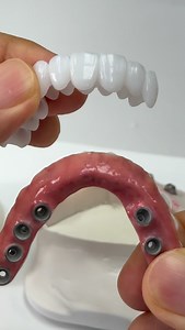 353K views · 4.6K reactions | Unbelievable ceramic implants case which is Syton 7 ! | CEO Luke Kahng | Facebook