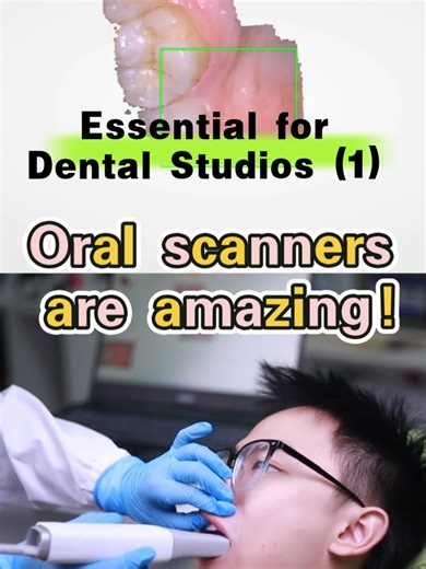 Essential for Dental Studios (1) - Oral scanners are amazing! #Dental #Dentistry #IntraoralScanner #DentalTech #DigitalDentistry #DentalTools #DentistLife #ClinicEssentials #DentalEquipment #DentalHacks #NoMoreGoopyImpressions #DentalClinic#DentalUpgrade #DentistTools #OralCareTech #DentalWorkflow #ClinicHacks#DentalInnovation #ScannerTech #DentalPractitioner